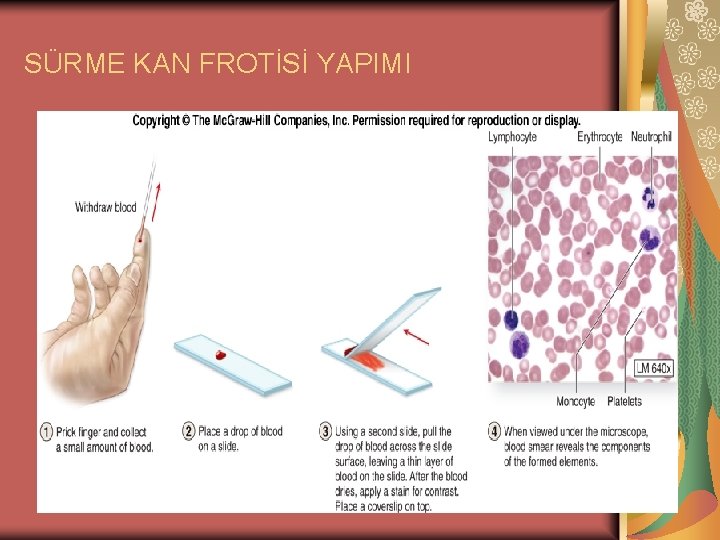 SÜRME KAN FROTİSİ YAPIMI 