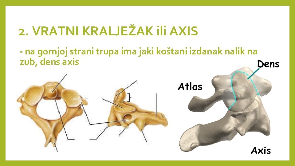 2. VRATNI KRALJEŽAK ili AXIS - na gornjoj strani trupa ima jaki koštani izdanak 2. VRATNI KRALJEŽAK ili AXIS - na gornjoj strani trupa ima jaki koštani izdanak