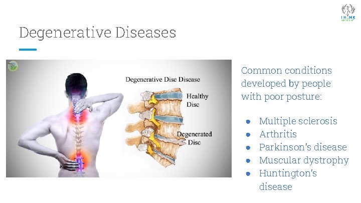 Degenerative Diseases Common conditions developed by people with poor posture: ● ● ● Multiple