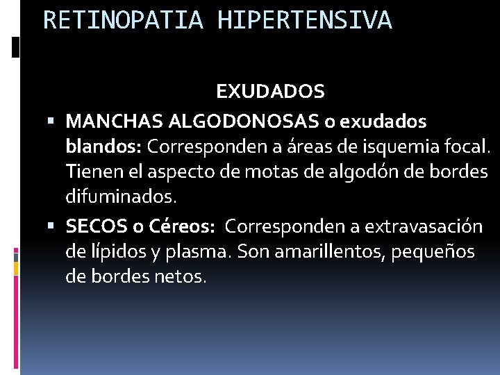 RETINOPATIA HIPERTENSIVA EXUDADOS MANCHAS ALGODONOSAS o exudados blandos: Corresponden a áreas de isquemia focal.