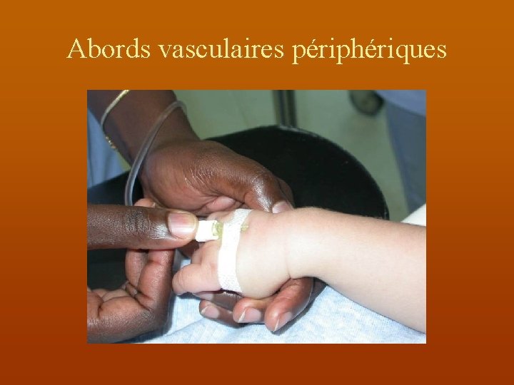 Abords vasculaires périphériques 