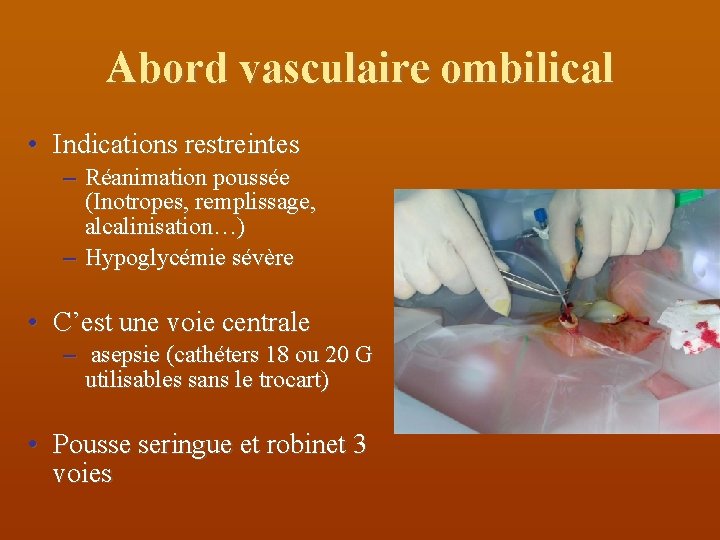 Abord vasculaire ombilical • Indications restreintes – Réanimation poussée (Inotropes, remplissage, alcalinisation…) – Hypoglycémie