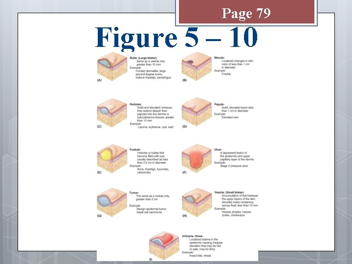 Page 79 Figure 5 – 10 