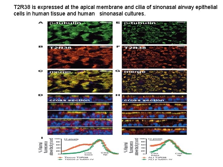 T 2 R 38 is expressed at the apical membrane and cilia of sinonasal