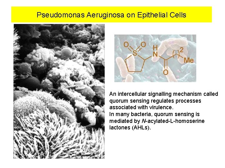 Pseudomonas Aeruginosa on Epithelial Cells An intercellular signalling mechanism called quorum sensing regulates processes