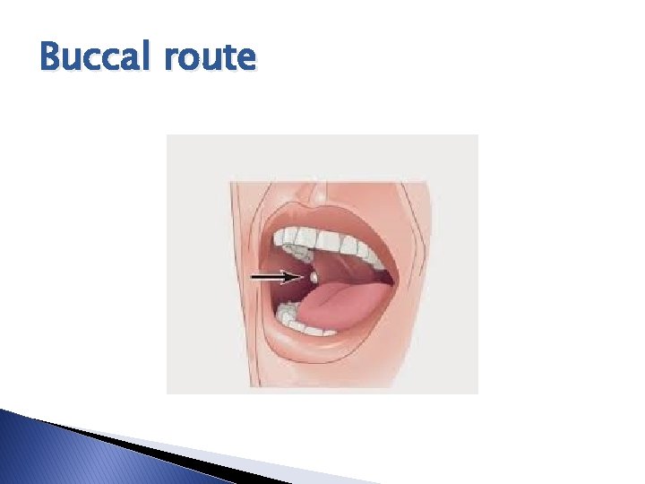 Buccal route Buccal route