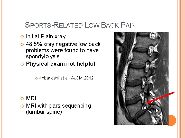 SPORTS-RELATED LOW BACK PAIN Initial Plain xray 48. 5% xray negative low back problems SPORTS-RELATED LOW BACK PAIN Initial Plain xray 48. 5% xray negative low back problems