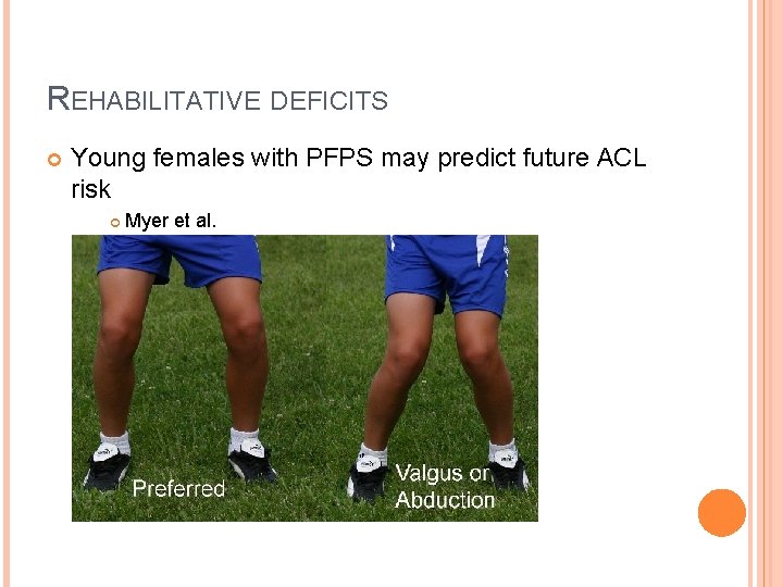 REHABILITATIVE DEFICITS Young females with PFPS may predict future ACL risk Myer et al. REHABILITATIVE DEFICITS Young females with PFPS may predict future ACL risk Myer et al.