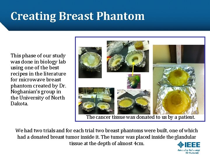 Creating Breast Phantom This phase of our study was done in biology lab using