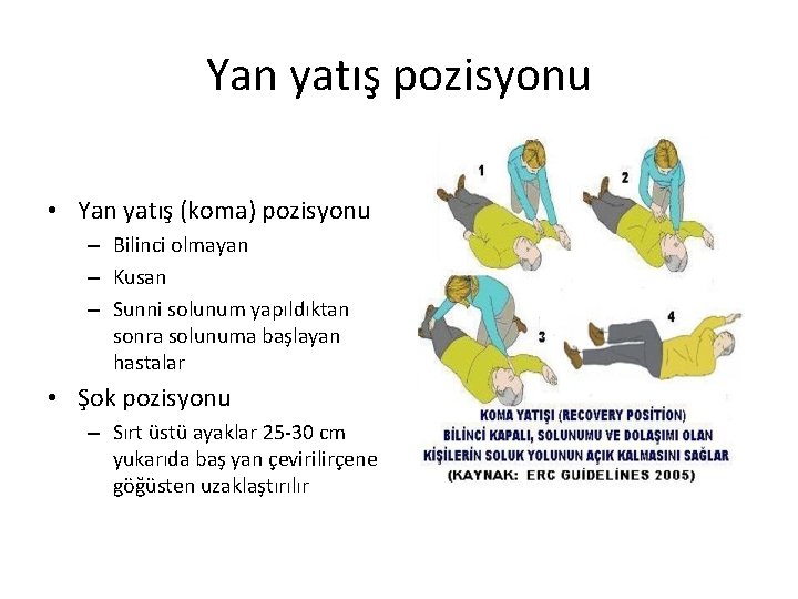 Yan yatış pozisyonu • Yan yatış (koma) pozisyonu – Bilinci olmayan – Kusan –