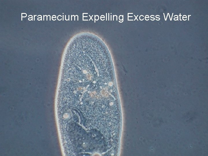 Paramecium Expelling Excess Water 