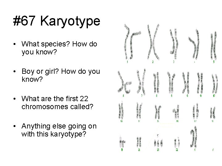 #67 Karyotype • What species? How do you know? • Boy or girl? How