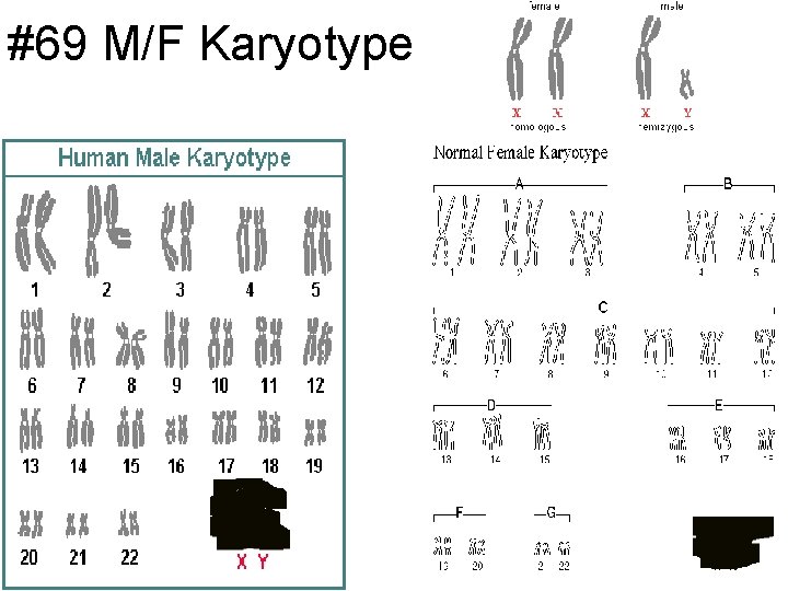 #69 M/F Karyotype 