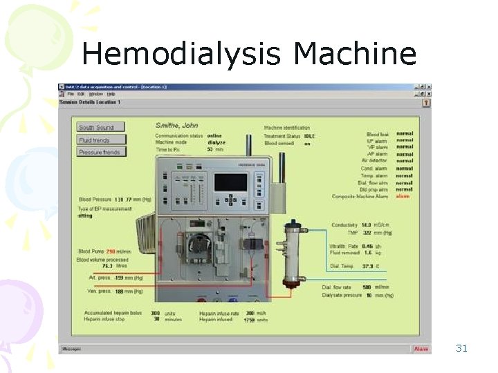 Hemodialysis Machine 31 