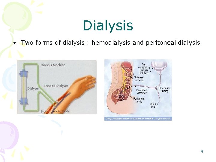 Dialysis • Two forms of dialysis : hemodialysis and peritoneal dialysis 4 