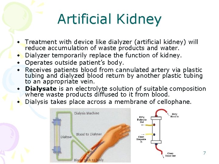 Artificial Kidney • Treatment with device like dialyzer (artificial kidney) will reduce accumulation of