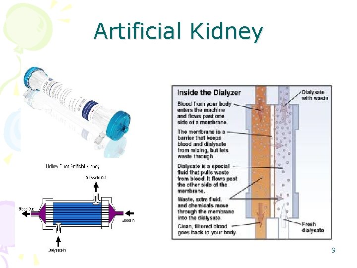 Artificial Kidney 9 