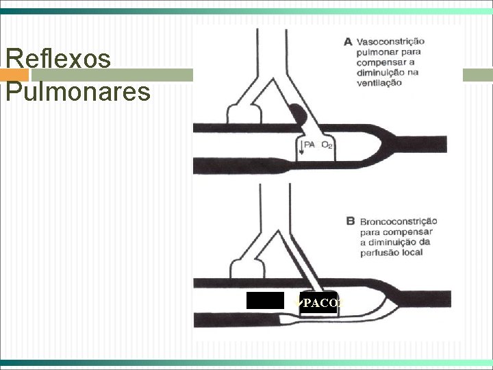 Reflexos Pulmonares PACO 2 Reflexos Pulmonares PACO 2