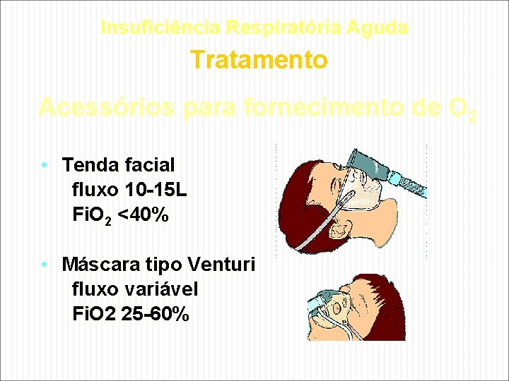 Insuficiência Respiratória Aguda Tratamento Acessórios para fornecimento de O 2 • Tenda facial fluxo Insuficiência Respiratória Aguda Tratamento Acessórios para fornecimento de O 2 • Tenda facial fluxo