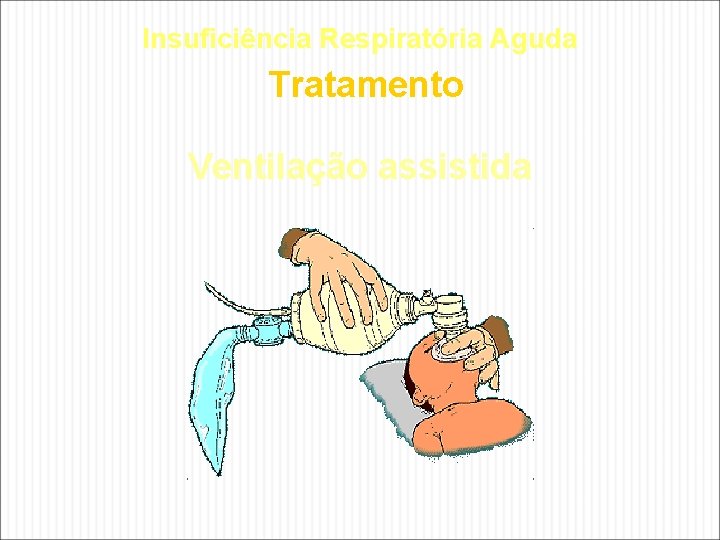 Insuficiência Respiratória Aguda Tratamento Ventilação assistida Insuficiência Respiratória Aguda Tratamento Ventilação assistida