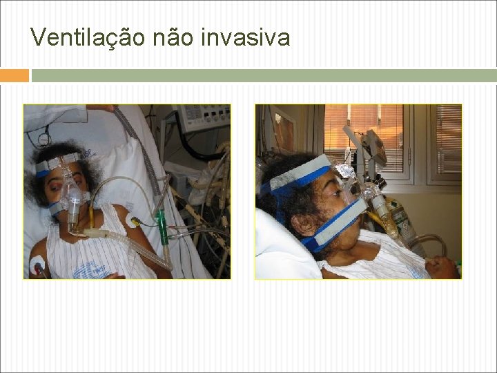 Ventilação não invasiva Ventilação não invasiva