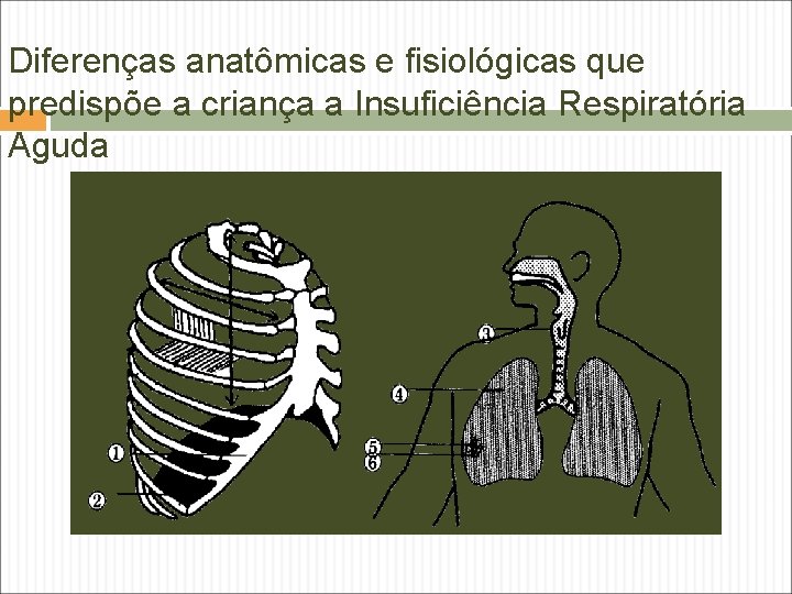 Diferenças anatômicas e fisiológicas que predispõe a criança a Insuficiência Respiratória Aguda Diferenças anatômicas e fisiológicas que predispõe a criança a Insuficiência Respiratória Aguda
