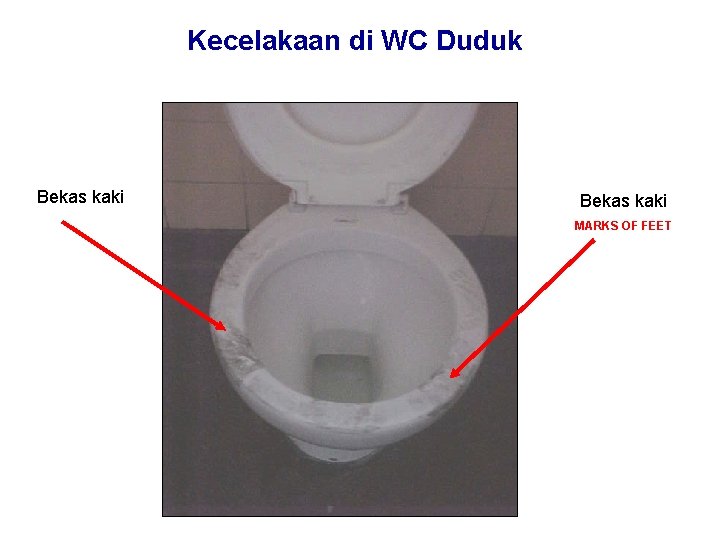 Kecelakaan di WC Duduk Bekas kaki MARKS OF FEET Kecelakaan di WC Duduk Bekas kaki MARKS OF FEET