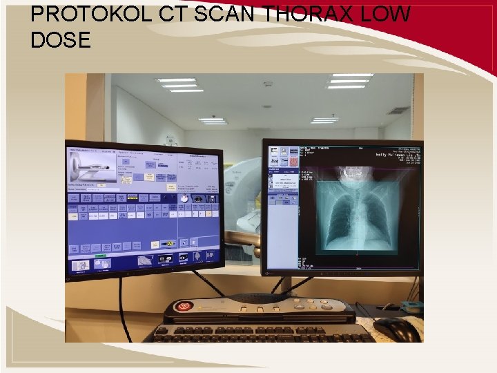 PROTOKOL CT SCAN THORAX LOW DOSE 