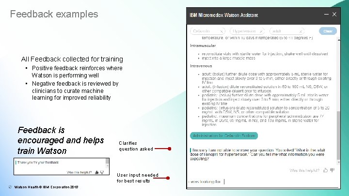 Feedback examples All Feedback collected for training • Positive feedback reinforces where Watson is Feedback examples All Feedback collected for training • Positive feedback reinforces where Watson is