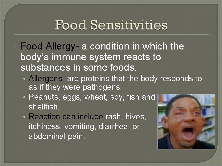  Food Allergy- a condition in which the body’s immune system reacts to substances