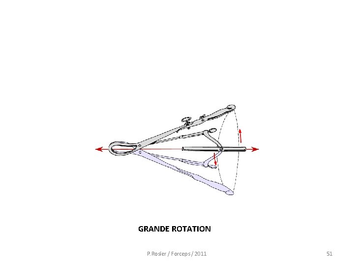  GRANDE ROTATION P. Rosier / Forceps / 2011 51 