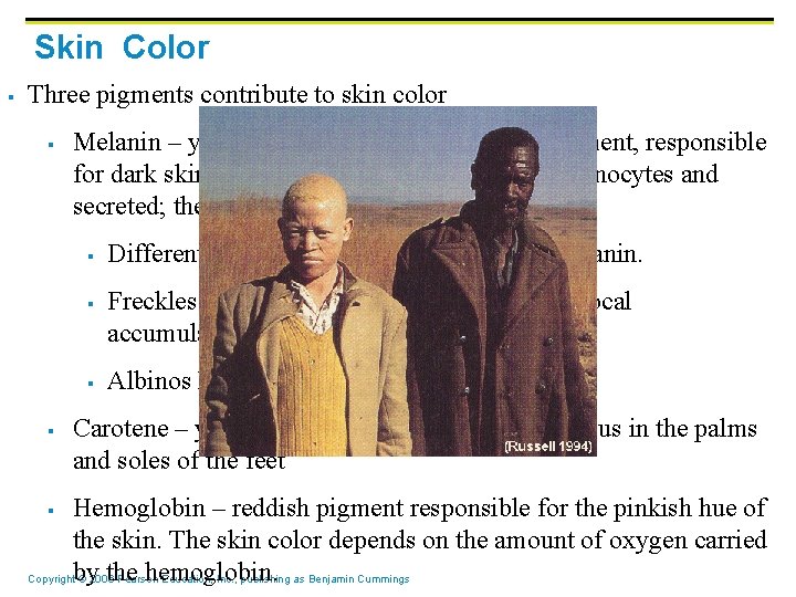 Skin Color § Three pigments contribute to skin color § Melanin – yellow to Skin Color § Three pigments contribute to skin color § Melanin – yellow to