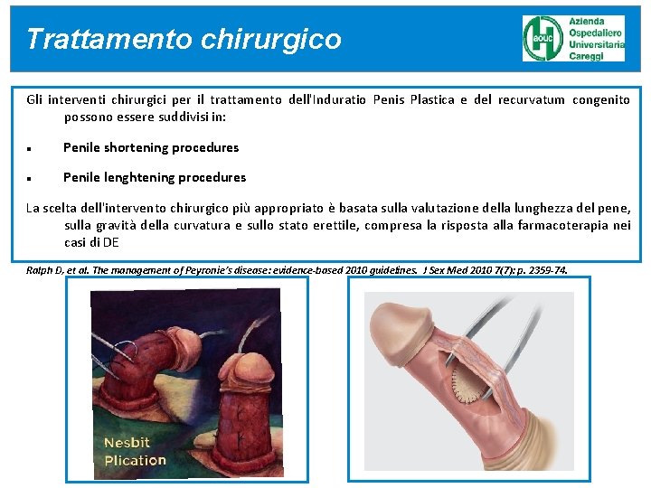 Trattamento DEVELOPMENT (fase Developmentchirurgico (fase 2 a)2 a) Gli interventi chirurgici per il trattamento Trattamento DEVELOPMENT (fase Developmentchirurgico (fase 2 a)2 a) Gli interventi chirurgici per il trattamento