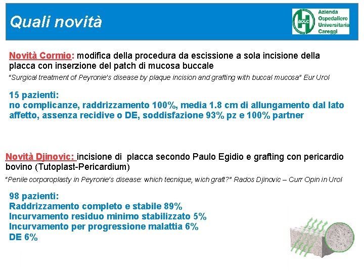 Quali novità Novità Cormio: modifica della procedura da escissione a sola incisione della placca Quali novità Novità Cormio: modifica della procedura da escissione a sola incisione della placca
