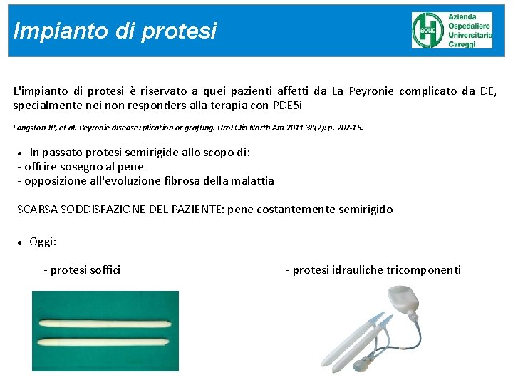 Impianto di protesi L'impianto di protesi è riservato a quei pazienti affetti da La Impianto di protesi L'impianto di protesi è riservato a quei pazienti affetti da La