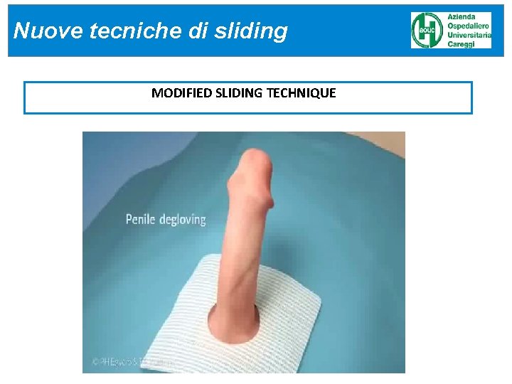 Nuove tecniche di sliding MODIFIED SLIDING TECHNIQUE Nuove tecniche di sliding MODIFIED SLIDING TECHNIQUE