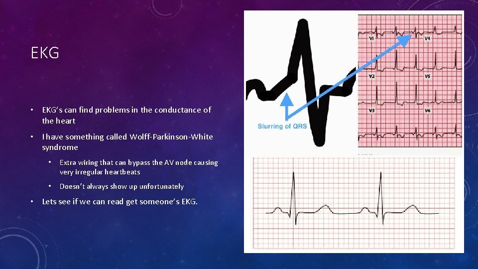 EKG • EKG’s can find problems in the conductance of the heart • I
