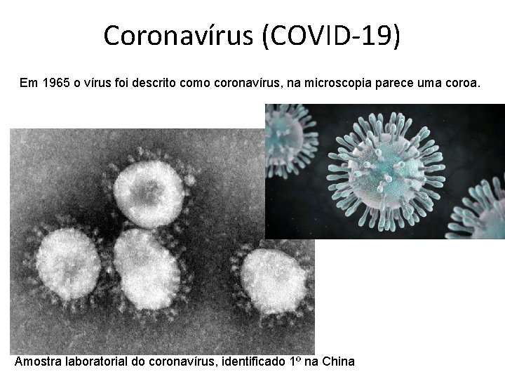 Coronavírus (COVID-19) Em 1965 o vírus foi descrito como coronavírus, na microscopia parece uma