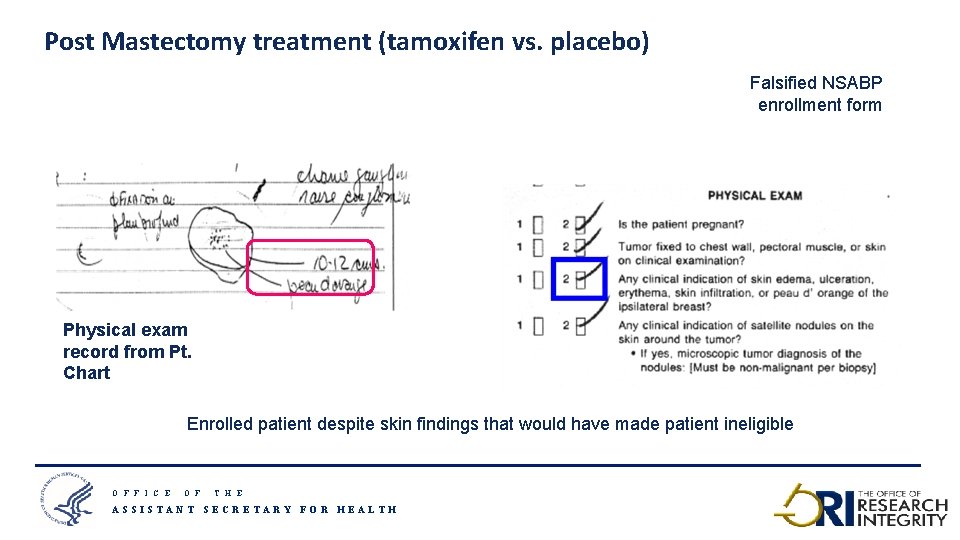 Post Mastectomy treatment (tamoxifen vs. placebo) Falsified NSABP enrollment form Physical exam record from