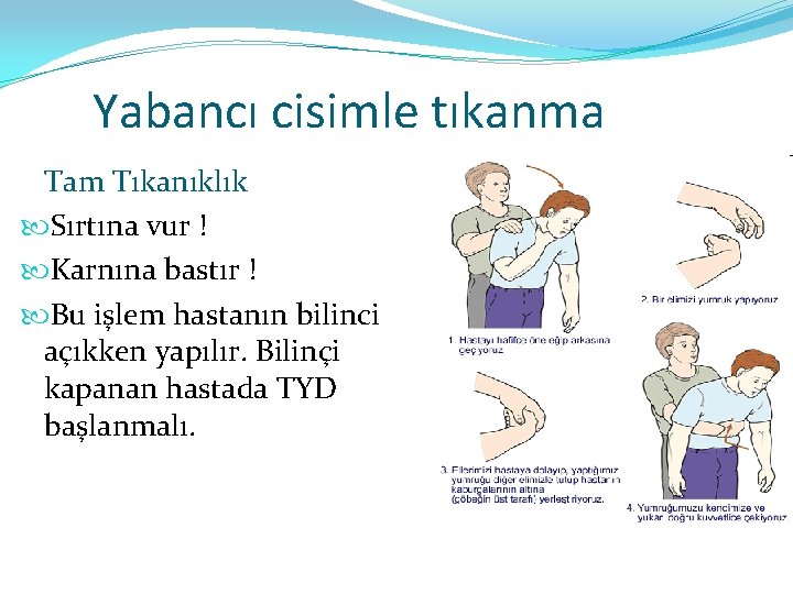 Yabancı cisimle tıkanma Tam Tıkanıklık Sırtına vur ! Karnına bastır ! Bu işlem hastanın