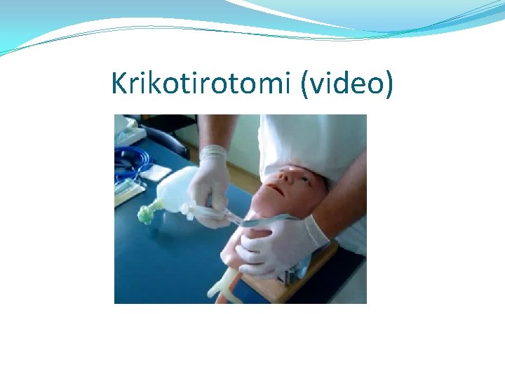 Krikotirotomi (video) 