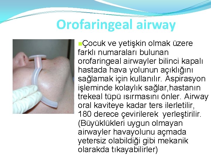 Orofaringeal airway nÇocuk ve yetişkin olmak üzere farklı numaraları bulunan orofaringeal airwayler bilinci kapalı