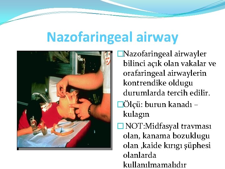 Nazofaringeal airway �Nazofaringeal airwayler bilinci açık olan vakalar ve orafaringeal airwaylerin kontrendike oldugu durumlarda
