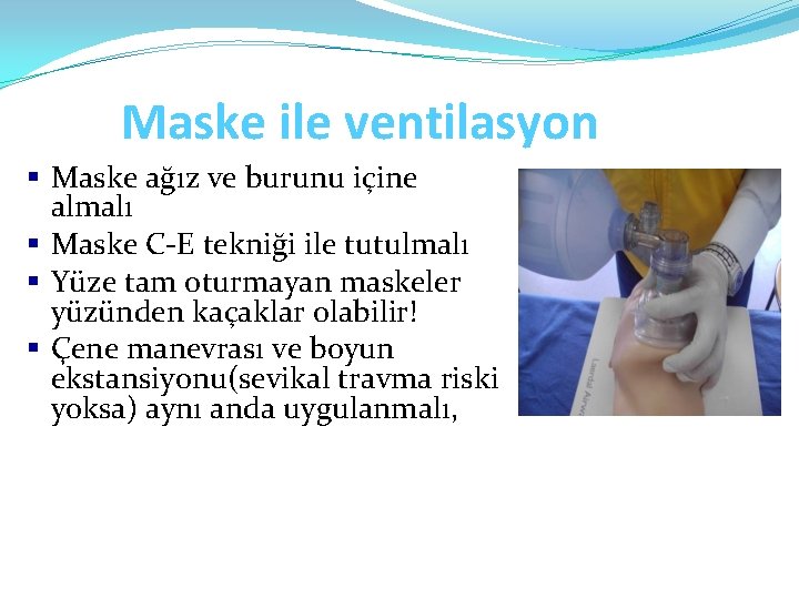 Maske ile ventilasyon § Maske ağız ve burunu içine almalı § Maske C-E tekniği