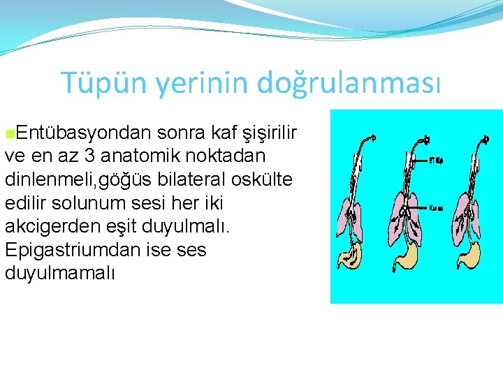 Tüpün yerinin doğrulanması n. Entübasyondan sonra kaf şişirilir ve en az 3 anatomik noktadan