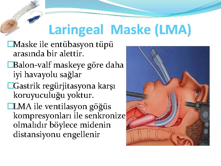 Laringeal Maske (LMA) �Maske ile entübasyon tüpü arasında bir alettir. �Balon-valf maskeye göre daha