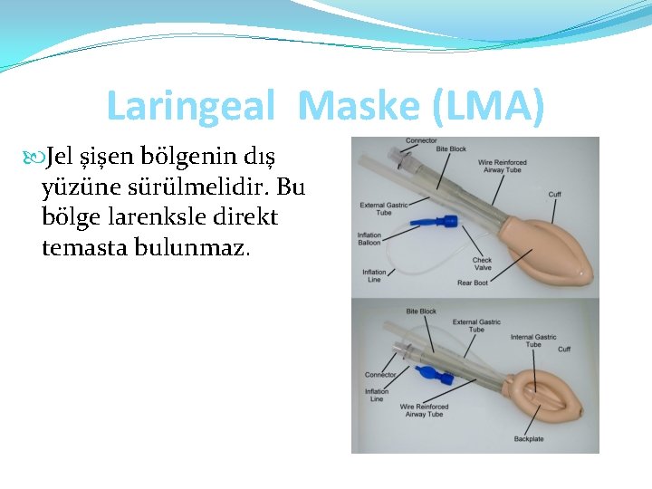 Laringeal Maske (LMA) Jel şişen bölgenin dış yüzüne sürülmelidir. Bu bölge larenksle direkt temasta