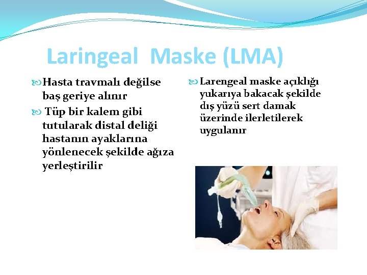 Laringeal Maske (LMA) Hasta travmalı değilse baş geriye alınır Tüp bir kalem gibi tutularak