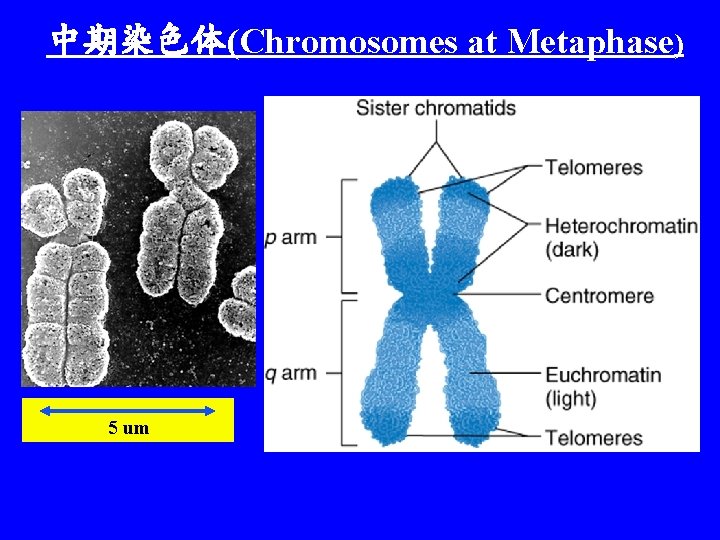 中期染色体(Chromosomes at Metaphase) 5 um 