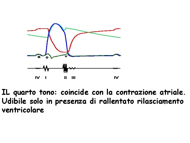 IL quarto tono: coincide con la contrazione atriale. Udibile solo in presenza di rallentato